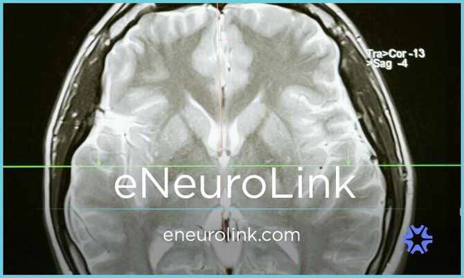 eNeuroLink.com